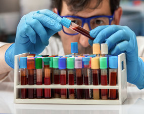 Stanovení koagulačních faktorů chromogenní a koagulační metodou