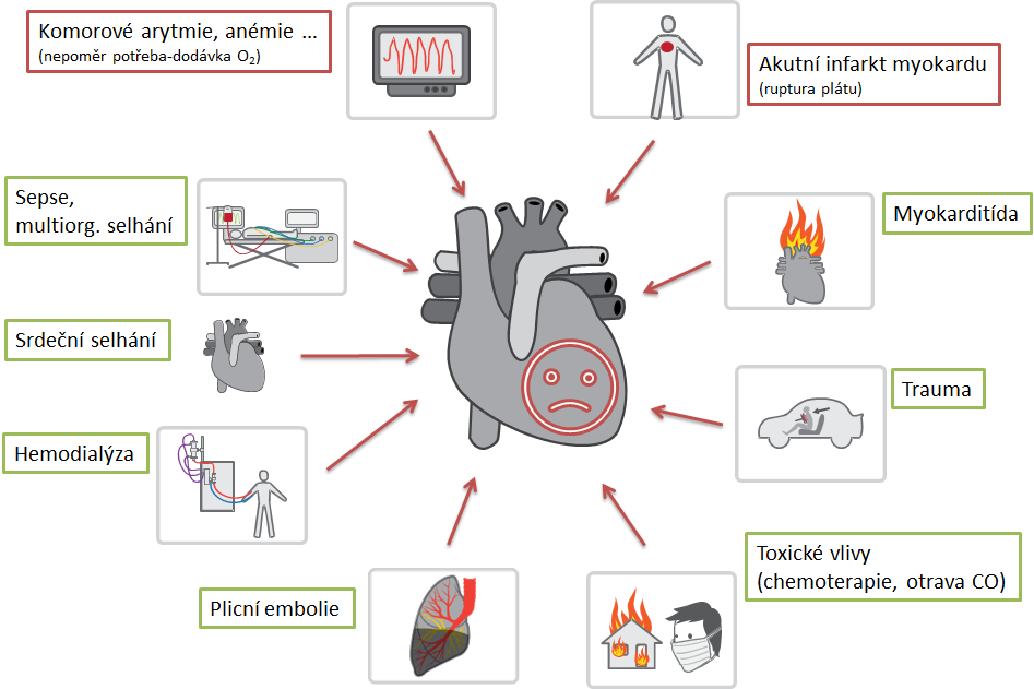 Příčiny zvýšení kardiálních troponinů.